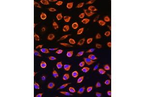 Immunofluorescence analysis of L929 cells using RND1 Rabbit pAb (ABIN6128639, ABIN6146997, ABIN6146998 and ABIN6217798) at dilution of 1:100. (RND1 Antikörper  (AA 103-232))