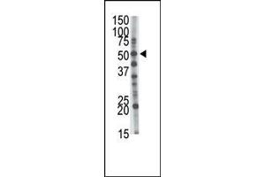 The anti-GCNT1 Pab (ABIN389033 and ABIN2839248) is used in Western blot to detect GCNT1 in mouse kidney tissue lysate.