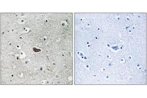 Immunohistochemistry analysis of paraffin-embedded human brain tissue, using PKC delta (Ab-645) Antibody. (PKC delta Antikörper  (AA 612-661))