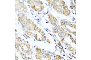 Immunohistochemistry of paraffin-embedded human stomach using D antibody (ABIN6127461, ABIN6139409, ABIN6139410 and ABIN6223779) at dilution of 1:100 (40x lens). (DARS2 Antikörper  (AA 406-645))