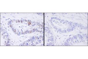 Immunohistochemistry (IHC) image for anti-Minichromosome Maintenance Complex Component 2 (MCM2) (pSer41) antibody (ABIN7448648) (MCM2 Antikörper  (pSer41))
