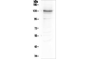 Western blot analysis of Integrin alpha 3 using anti-Integrin alpha 3 antibody (ABIN6719410). (ITGA3 Antikörper)