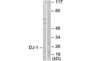 Western blot analysis of extracts from HuvEc cells, using DJ-1 Antibody. (PARK7/DJ1 Antikörper  (AA 21-70))
