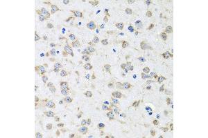 Immunohistochemistry of paraffin-embedded mouse brain using RPLP1 antibody at dilution of 1:100 (x40 lens). (RPLP1 Antikörper)