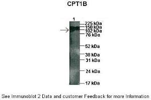 Sample Type :  1: 45ug human capan1 cell lysate  Primary Antibody Dilution :  1:1000  Secondary Antibody :  Anti-rabbit HRP  Secondary Antibody Dilution :  1:5000  Color/Signal Descriptions :  ARP46444-QC16367-WB-image-02  Gene Name :  CPT1B  Submitted by :  Dr. (CPT1B Antikörper  (Middle Region))