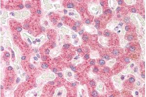 Immunohistochemistry (IHC) image for anti-Ribosomal Protein S19 (RPS19) (Internal Region) antibody (ABIN185519)