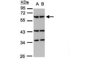 WB Image Sample (30μg whole cell lysate) A:293T B:A431, 7. (Coronin 1a Antikörper  (C-Term))