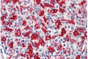 Human Spleen (formalin-fixed, paraffin-embedded) stained with HMOX1 antibody ABIN462109 at 10 ug/ml followed by biotinylated goat anti-rabbit IgG secondary antibody ABIN481713, alkaline phosphatase-streptavidin and chromogen. (HMOX1 Antikörper)