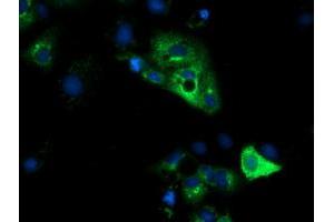 Anti-HP mouse monoclonal antibody (ABIN2453134) immunofluorescent staining of COS7 cells transiently transfected by pCMV6-ENTRY HP (RC223612). (Haptoglobin Antikörper)