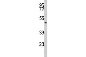 Western blot analysis of Acrosin antibody and human Jurkat lysate. (Acrosin Antikörper  (AA 387-416))