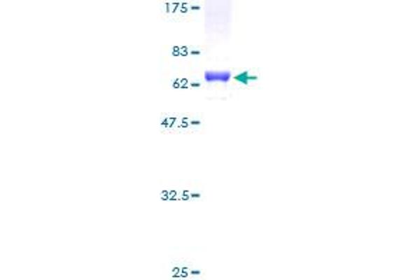 SIX Homeobox 1 Protein (SIX1) (AA 1-284) (GST tag)