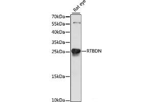 Western blot analysis of extracts of Rat eye using RTBDN Polyclonal Antibody at dilution of 1:1000. (Retbindin Antikörper)