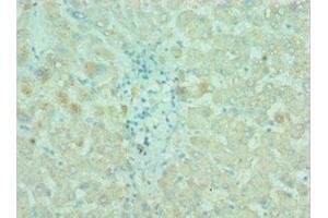 Immunohistochemistry of paraffin-embedded human liver tissue using ABIN7145198 at dilution of 1:100 (BIRC2 Antikörper  (AA 1-300))