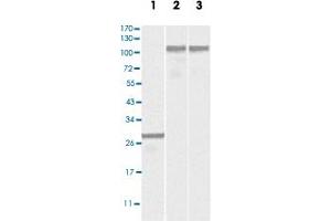 Western blot analysis using DNM2 monoclonal antibody, clone 5E4C2F3  against truncated DNM2 recombinant protein (Lane 1), SK-N-SH (Lane 2) and NIH/3T3 (Lane 3) cell lysates. (DNM2 Antikörper)