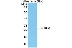Western Blotting (WB) image for anti-Cytotoxic T-Lymphocyte-Associated Protein 4 (CTLA4) (AA 52-211) antibody (ABIN1858526) (CTLA4 Antikörper  (AA 52-211))