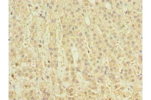 Immunohistochemistry of paraffin-embedded human adrenal gland tissue using  at dilution of 1:100 (CLEC4C Antikörper  (AA 45-213))