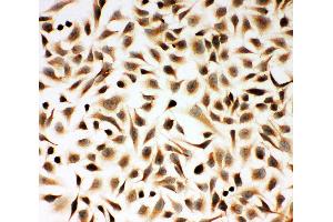 Anti-Smad2 antibody, ICC ICC: HELA Cell (SMAD2 Antikörper  (N-Term))