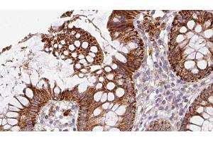 ABIN6272858 at 1/100 staining Mouse colon tissue by IHC-P. (IFT20 Antikörper)