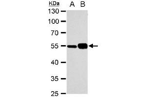 WB Image alpha Tubulin 1A antibody detects alpha Tubulin 1A protein by western blot analysis. (TUBA1A Antikörper)