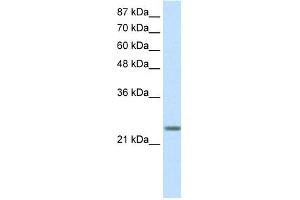 WB Suggested Anti-MXD3 Antibody Titration: 0.