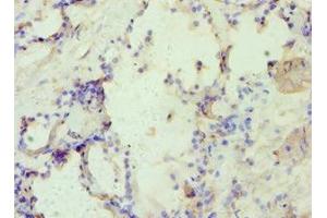 Immunohistochemistry of paraffin-embedded human prostate tissue using ABIN7144361 at dilution of 1:100