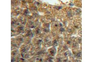 Used in DAB staining on fromalin fixed paraffin-embedded Liver tissue (IRF5 Antikörper  (AA 3-250))