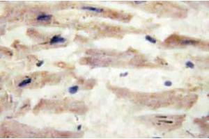 Immunohistochemistry (IHC) analyzes of Laminin alpha-4 antibody in paraffin-embedded human heart tissue. (LAMa4 Antikörper)