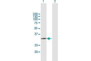 Western Blot analysis of ZCCHC9 expression in transfected 293T cell line by ZCCHC9 MaxPab polyclonal antibody. (ZCCHC9 Antikörper  (AA 1-271))