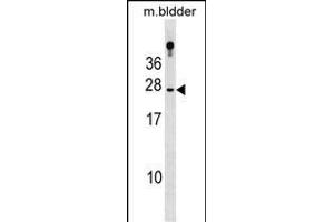 RBP4 Antibody (N-term) (ABIN1881735 and ABIN2839028) western blot analysis in mouse bladder tissue lysates (35 μg/lane).