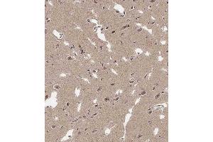 Immunohistochemistry (Paraffin-embedded Sections) (IHC (p)) image for anti-ADAM Metallopeptidase with thrombospondin Type 1 Motif, 17 (ADAMTS17) (AA 508-540) antibody (ABIN6243834)