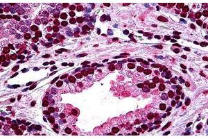 Human Prostate: Formalin-Fixed, Paraffin-Embedded (FFPE) (DLX2 Antikörper  (AA 1-110))