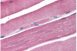 Human Skeletal Muscle (formalin-fixed, paraffin-embedded) stained with DCLRE1A antibody ABIN298128 at 2. (SNM1 Antikörper  (AA 397-410))