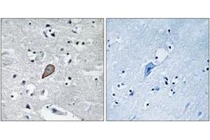 Immunohistochemistry analysis of paraffin-embedded human brain carcinoma tissue, using PKC thet (Ab-538) Antibody. (PKC theta Antikörper  (AA 504-553))