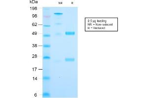 SDS-PAGE Analysis Purified Cytochrome C Recombinant Rabbit Monoclonal (CYCS/3128R). (Rekombinanter Cytochrome C Antikörper)