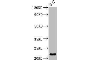 Western Blot Positive WB detected in: U87 whole cell lysate All lanes: AK1 antibody at 2. (Adenylate Kinase 1 Antikörper  (AA 1-194))