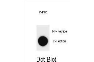 Dot blot analysis of Phospho-ERBB2- Antibody Phospho-specific Pab m on nitrocellulose membrane.