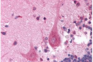 Human Brain, Cerebellum (formalin-fixed, paraffin-embedded) stained with PITX3 antibody ABIN214803 at 5 ug/ml followed by biotinylated goat anti-rabbit IgG secondary antibody ABIN481713, alkaline phosphatase-streptavidin and chromogen. (PITX3 Antikörper  (N-Term))