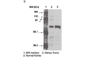 Western blot using CYP4F11 antibody one normal (2) and cancerous (3) kidney cell lysates. (CYP4F11 Antikörper  (C-Term))