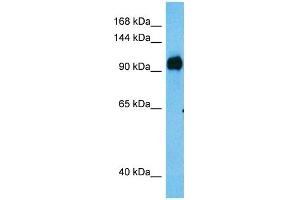Host:  Rabbit  Target Name:  MAP3K13  Sample Tissue:  Human HT1080 Whole Cell lysates  Antibody Dilution:  1ug/ml (MAP3K13 Antikörper  (C-Term))