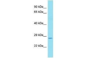 Western Blotting (WB) image for anti-Potassium Large Conductance Calcium-Activated Channel, Subfamily M, beta Member 2 (KCNMB2) (C-Term) antibody (ABIN2776339)