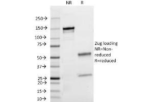 SDS-PAGE Analysis Purified Lambda Light Chain Mouse Monoclonal Antibody (HP6054). (IgL Antikörper)