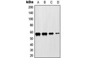 Western blot analysis of ZNF682 expression in HeLa (A), Jurkat (B), NIH3T3 (C), H9C2 (D) whole cell lysates. (ZNF682 Antikörper  (N-Term))