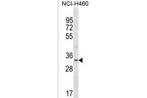 FBLL1 Antikörper  (AA 209-236)