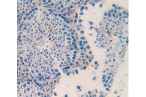 IHC-P analysis of Mouse Tissue, with DAB staining. (ACVR2A Antikörper  (AA 326-485))