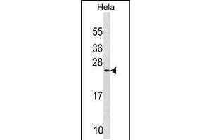 Western blot analysis in Hela cell line lysates (35ug/lane). (PRELID1 Antikörper  (N-Term))