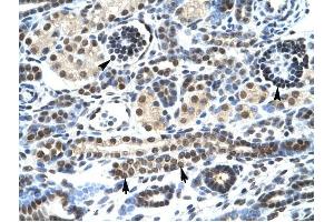 HTR3A antibody was used for immunohistochemistry at a concentration of 4-8 ug/ml to stain Epithelial cells of renal tubule (lndicated with Arrows] and renal corpuscle (Indicated with Arrow Heads) in Human Kidney. (Serotonin Receptor 3A Antikörper  (N-Term))
