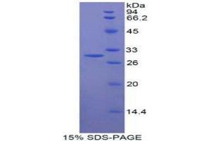 SDS-PAGE (SDS) image for MFNG (MFNG) (AA 80-316) protein (His tag) (ABIN1878341)