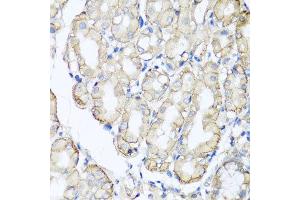 Immunohistochemistry of paraffin-embedded human stomach using AHCYL1 antibody at dilution of 1:100 (x40 lens).