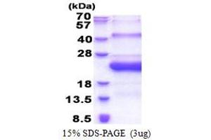 Sperm Mitochondria Associated Cysteine Rich Protein (SMCP) (AA 1-116) protein (His tag)