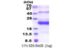 SDS-PAGE (SDS) image for Sperm Mitochondria Associated Cysteine Rich Protein (SMCP) (AA 1-116) protein (His tag) (ABIN5853274)